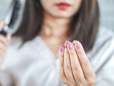 Covid et chute de cheveux